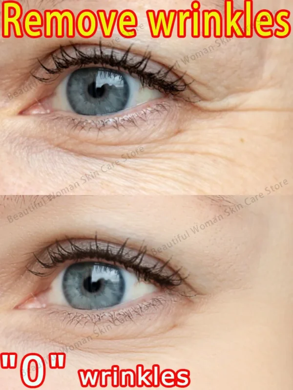 Anti-wrinkle cream removes wrinkles - Image 4