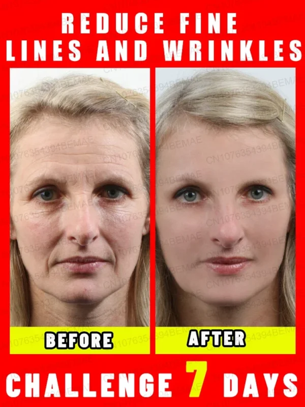 Anti-wrinkle cream removes wrinkles - Image 6