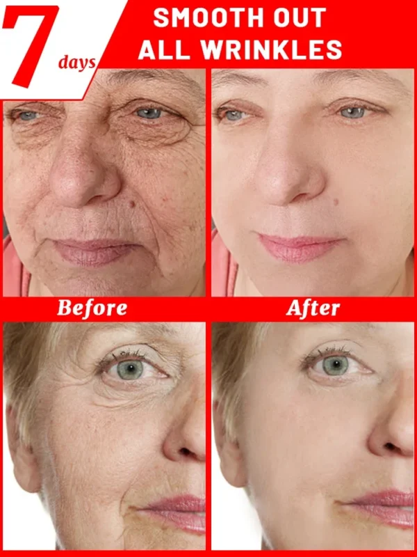 Anti-wrinkle cream removes wrinkles - Image 3