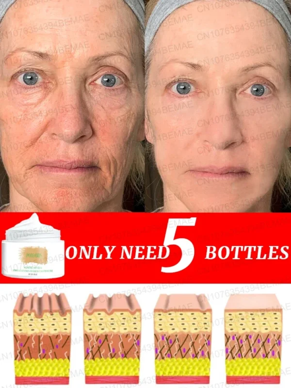 Anti-wrinkle cream removes wrinkles - Image 5